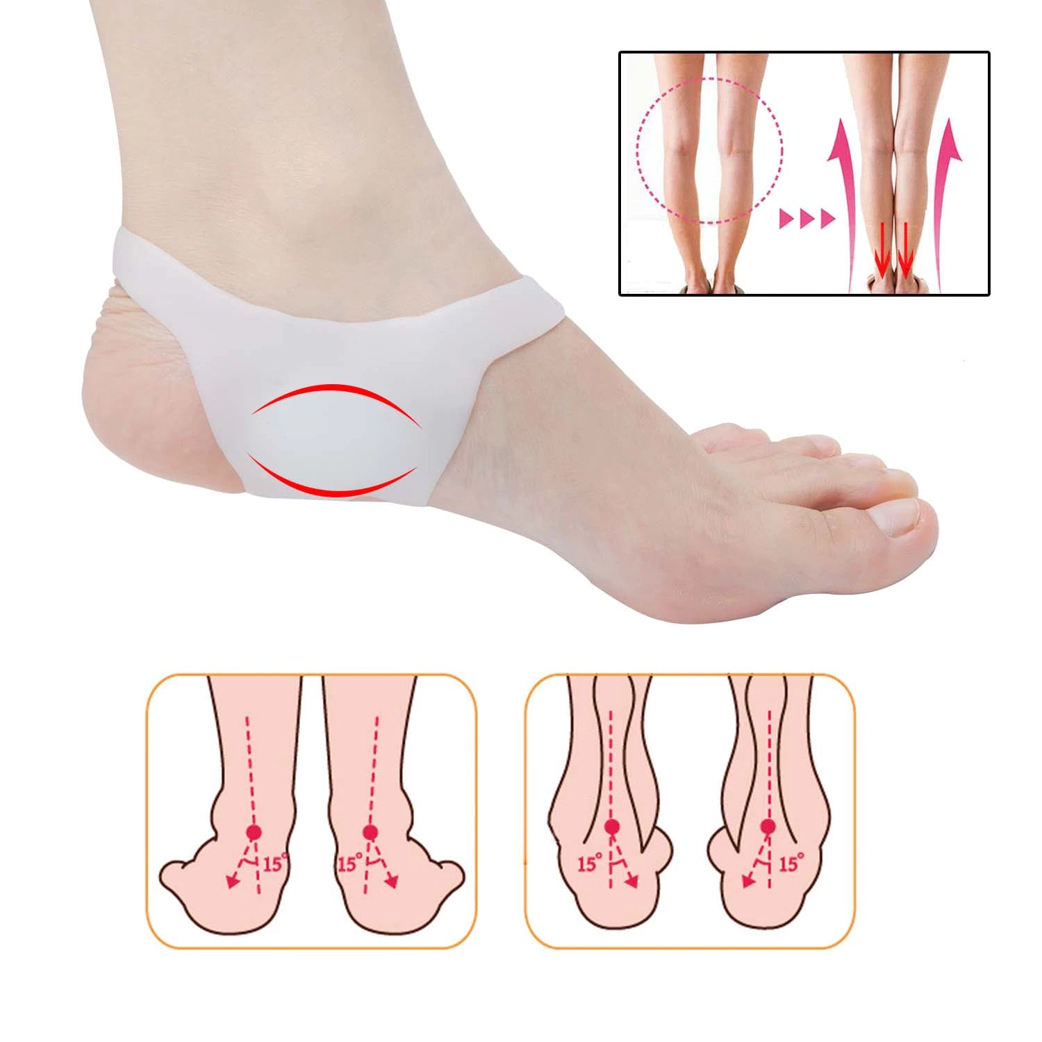 Flat Foot Corrector Fixic Arch Support Insoles 2-Pair Set (Beige