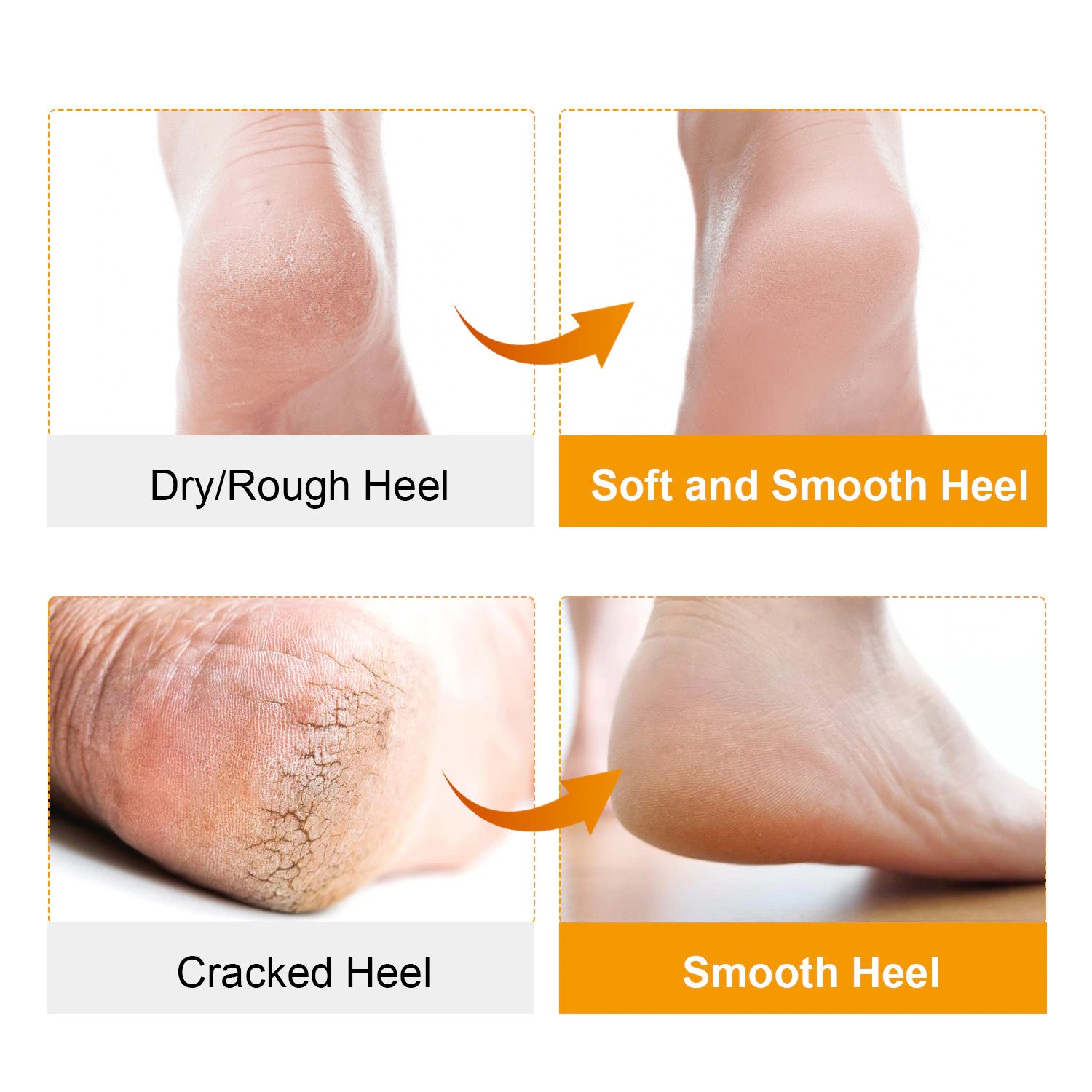 Moisturizing Socks Lotion Gel for Dry Cracked Heels - Spa Gel Socks  Humectant Moisturizer Heel Balm Foot